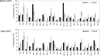 Novel NHEJ1 pathogenic variant linked to severe combined immunodeficiency, microcephaly, and abnormal T and B cell receptor repertoires